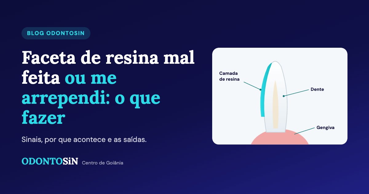 Faceta de resina mal feita: como evitar e o que fazer